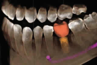 Dealing with Common Dental Ailments