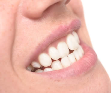 Great Snacks for Your Kid's Teeth
