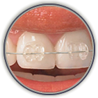 Taking Care of Your Smile through General Dentistry