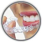 How to Prepare Your Teen for Invisalign