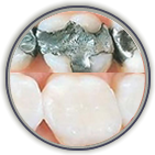 Reasons Your Teeth May No Longer Be White
