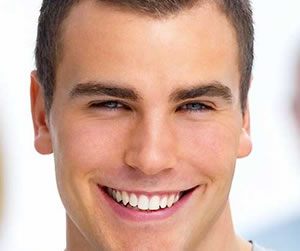 Benefits of Dental Crowns and Bridges