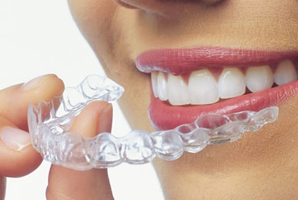 Who Is a Candidate for Invisalign?