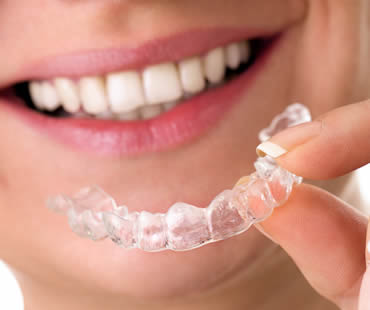 Adults: Experiencing Life with Invisalign
