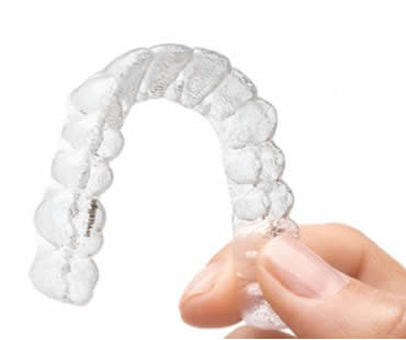 Unlocking Your Best Smile with Invisalign