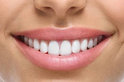 How Do You Define the Perfect Smile?