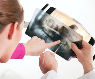 How to Know You Need Root Canal Therapy