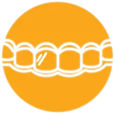 Custom Clear Aligners