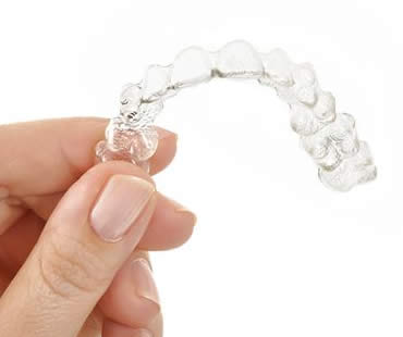 Invisalign: A Modern Way to Improve your Smile