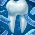 Causes and Effects of Gingivitis